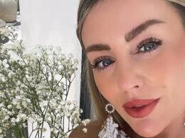 British health influencer and beautician, 33, fighting for her life after arm was crushed in horror Indonesia scooter crash