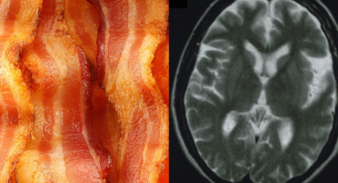 Eating more processed red meat is linked to an increased risk of dementia, study suggests