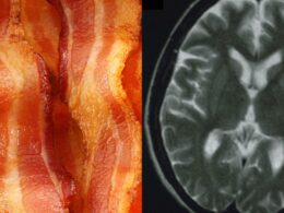 Eating more processed red meat is linked to an increased risk of dementia, study suggests