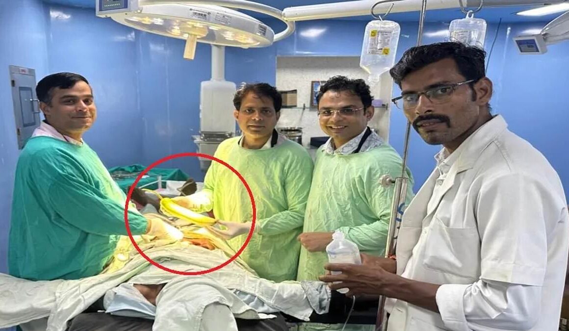 Oooh arrrrgh! Doctors remove 18-inch vegetable from farmer’s rear after he complained of stomach pains