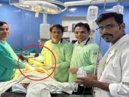 Oooh arrrrgh! Doctors remove 18-inch vegetable from farmer’s rear after he complained of stomach pains