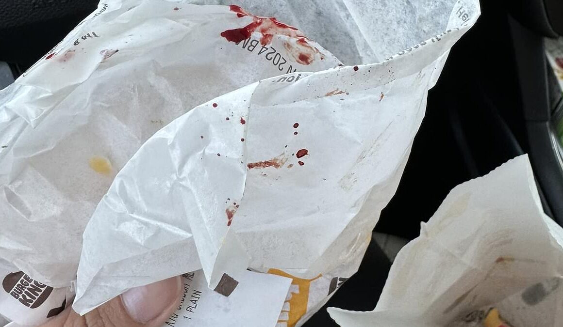 Mother horrified after finding daughter’s Burger King kids’ meal splattered with blood when she said ‘Mom, I don’t want ketchup’