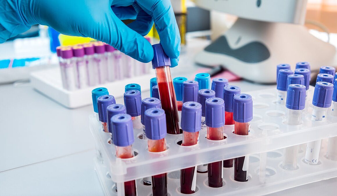 New breakthrough blood testing technology can accurately diagnose Alzheimer’s in 90% of dementia cases