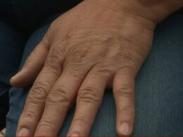 More than 2,000 patients are exposed to HIV and hepatitis after huge breach in hospital protocols
