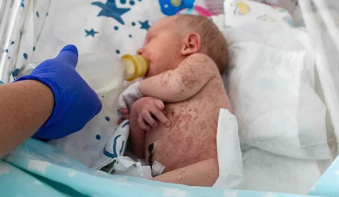 Newborn girl is found covered in agonising bites and severe sunburn after being abandoned on an ANT HILL by her mother who now faces attempted murder charge in Russia