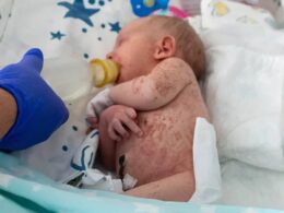 Newborn girl is found covered in agonising bites and severe sunburn after being abandoned on an ANT HILL by her mother who now faces attempted murder charge in Russia