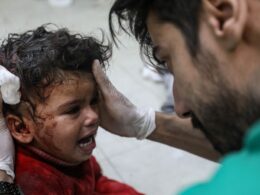 Doctors in Gaza describe the horror of caring for children affected by war