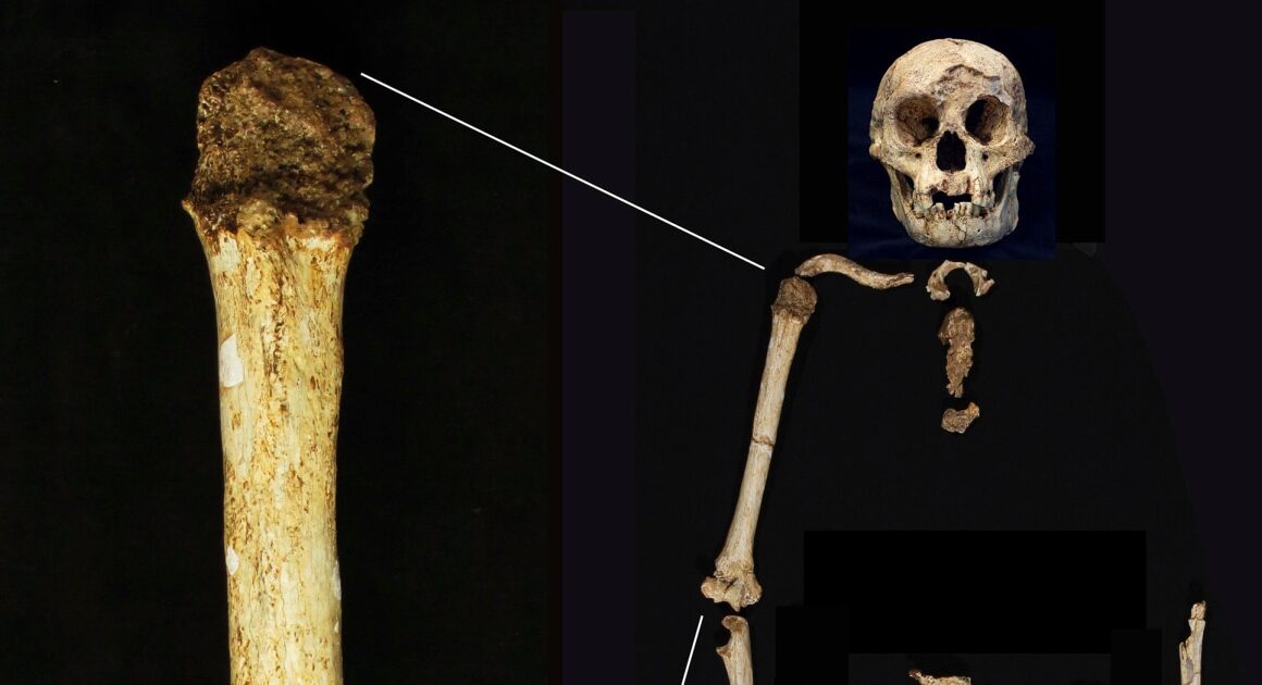 Fossils suggest early human ‘hobbits’ had ancestors who were even smaller