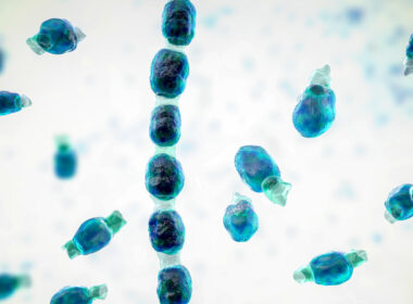 14 people got Valley fever after a California music festival, highlighting the fungus’ growing threat