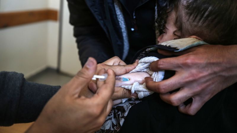 A 10-month-old has contracted Gaza’s first case of polio in 25 years