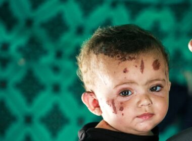 It will take a village to raise Reem, the baby whose entire family was killed in a strike